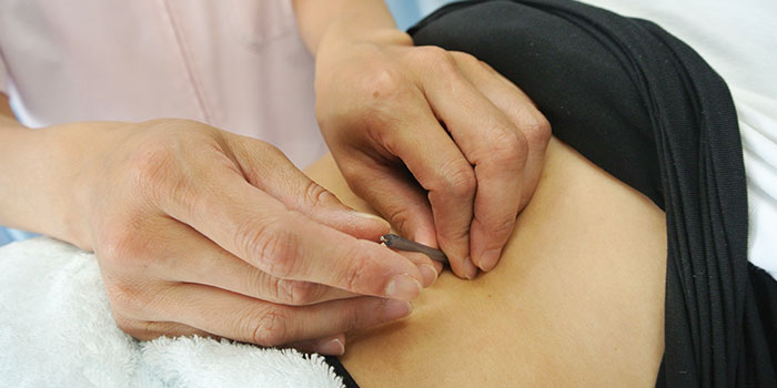 トリガーポイントへの施術